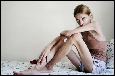 Anoressia