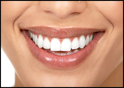 Sbiancamento dei denti